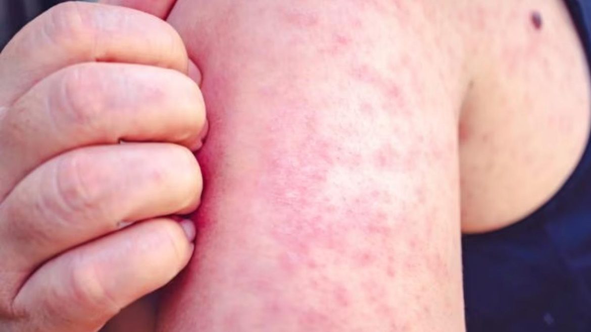 votre-bras-gratte-?-prenez-ce-signal-tres-au-serieux,-il-peut-reveler-un-veritable-probleme-de-sante
