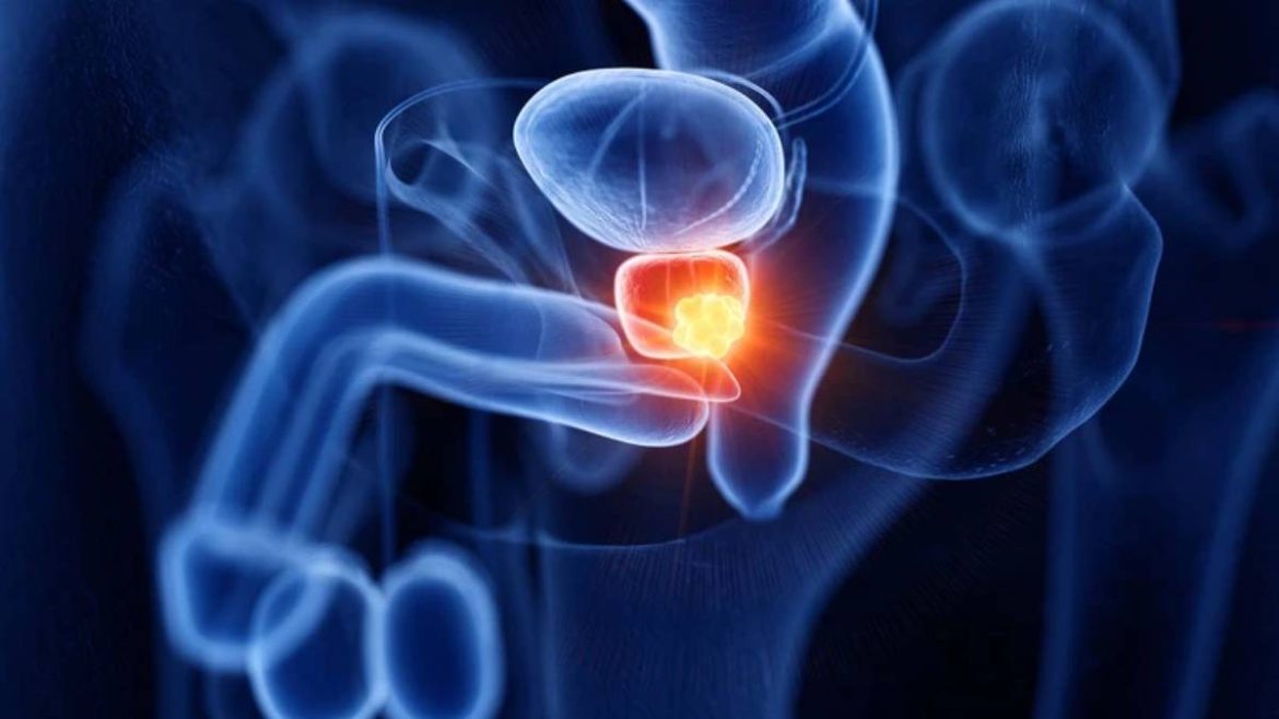 ce-geste-banal-augmente-le-risque-de-cancer-de-la-prostate-de-45-%-chez-les-hommes