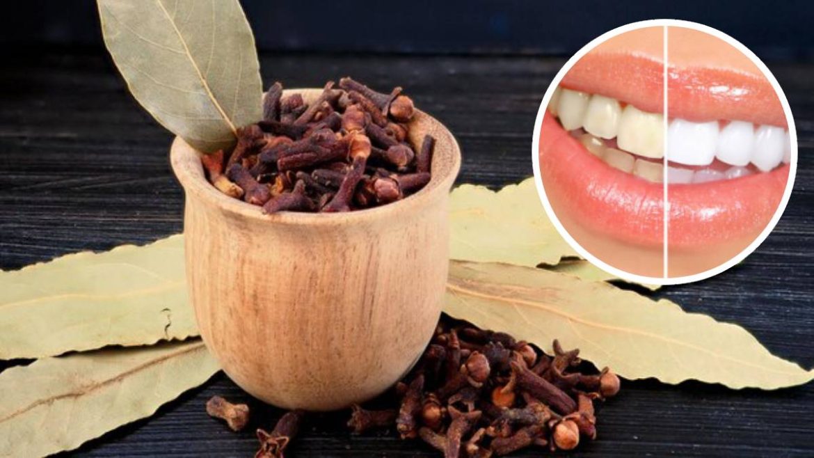 faites-ceci-avec-du-laurier-et-des-clous-de-girofle-pour-des-dents-blanches-naturellement
